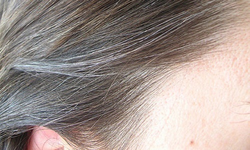 جلوگیری از سفید شدن مو